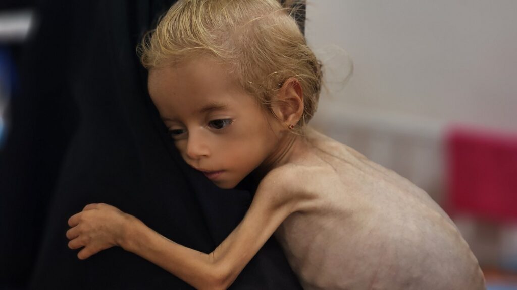 Global Hunger Monitor می گوید ، قحطی به غزه زده است