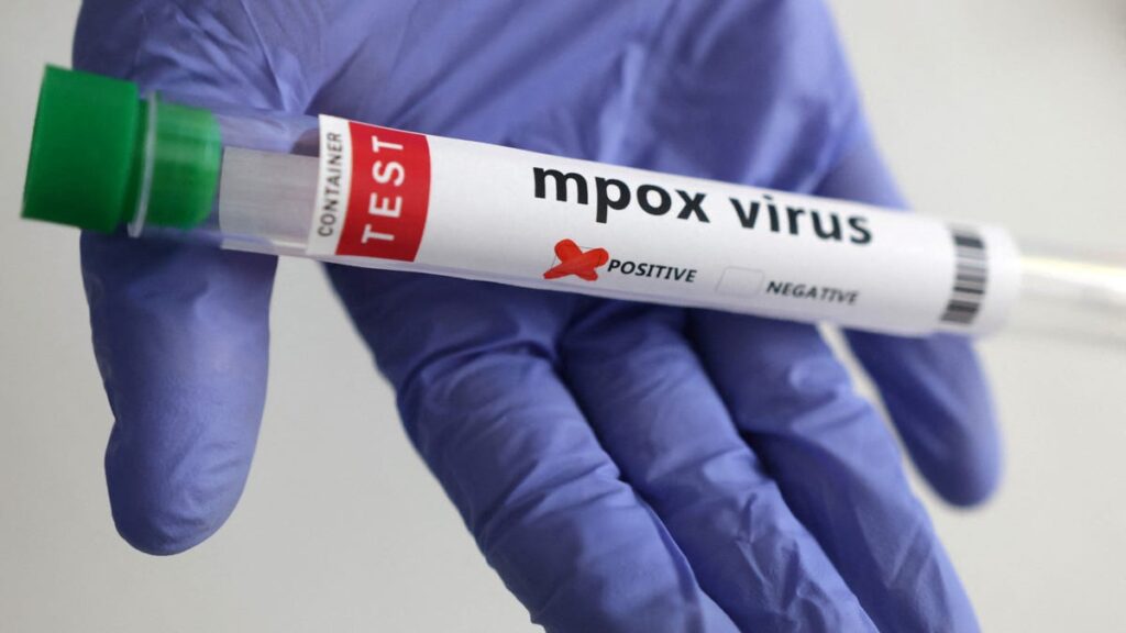 موارد MPOX در کالیفرنیا مرتبط با سفر بین المللی تأیید شده است